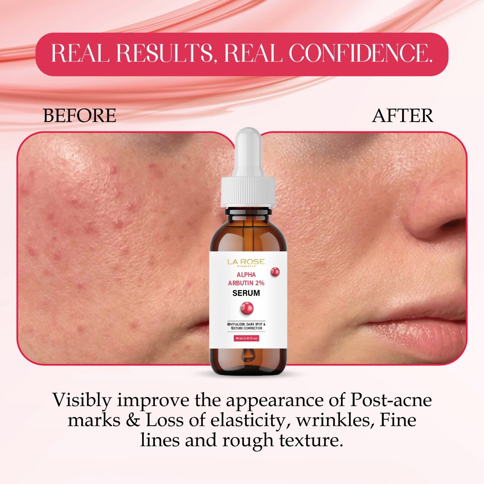 LA ROSE ETERNELLE Alpha Arbutin 2% Serum, Dark Spot & Texture Corrector, 30ml