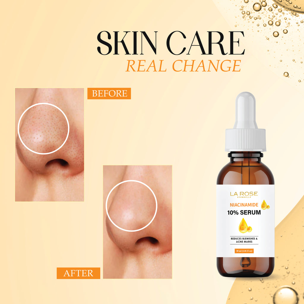 LA ROSE ETERNELLE Niacinamide 10% Serum, Reduces Blemishes and Acne Marks, 30 ml
