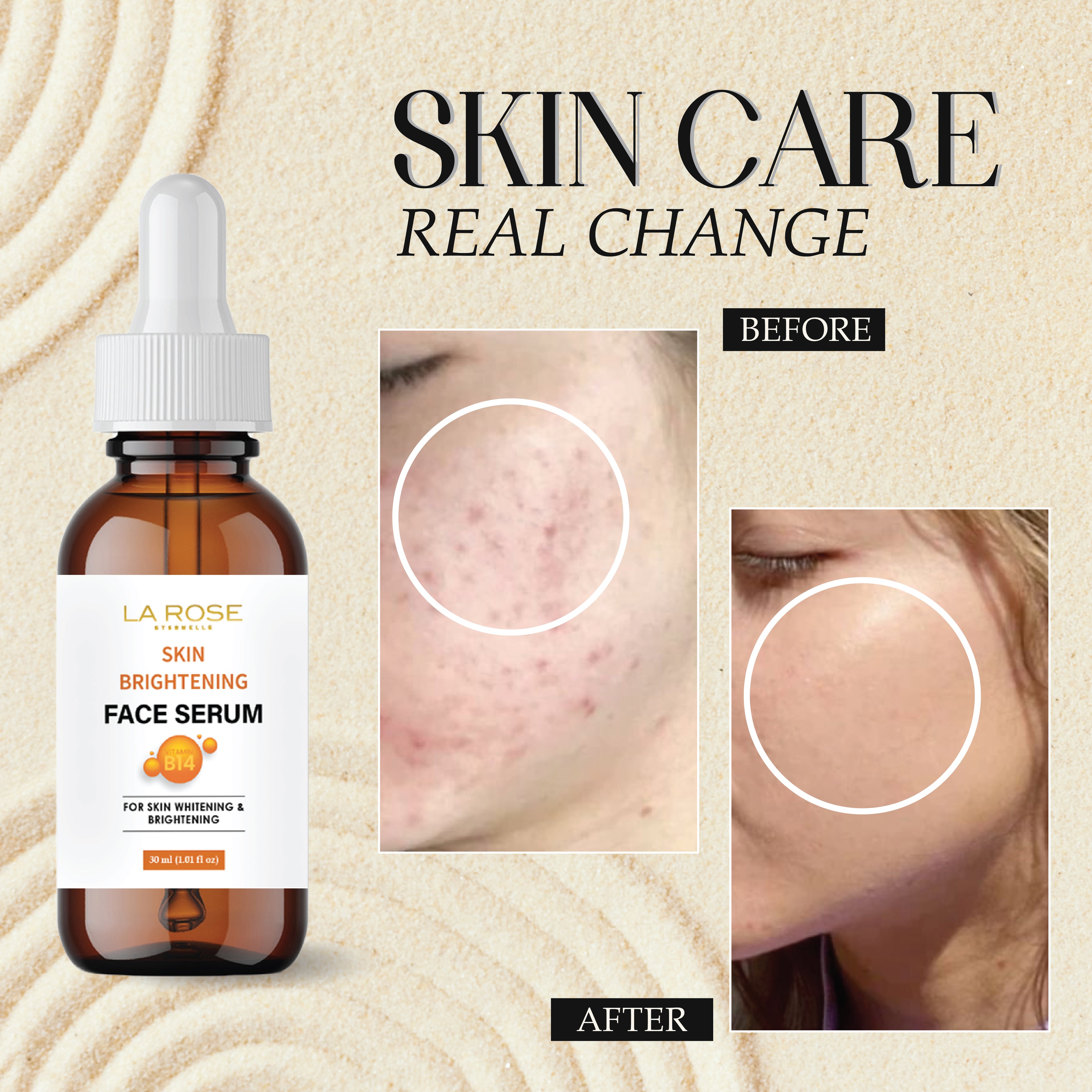 LA ROSE ETERNELLE Skin Brightening Face Serum, 30ml, with 10% Niacinamide for Blemish Control