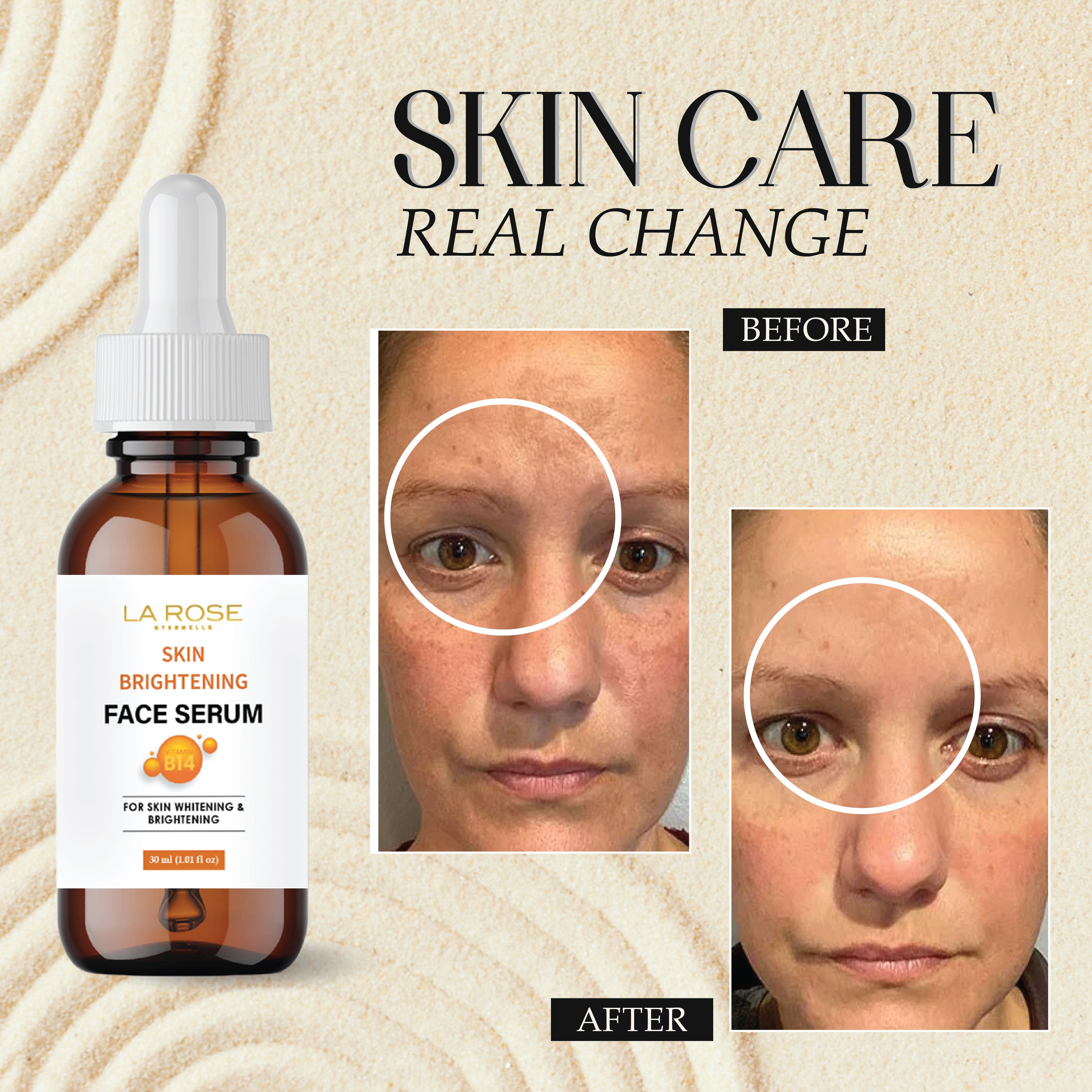 LA ROSE ETERNELLE Skin Brightening Face Serum, 30ml, with 10% Niacinamide for Blemish Control